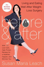 Before & After : Living and Eating Well After Weight-Loss Surgery - Susan Maria Leach