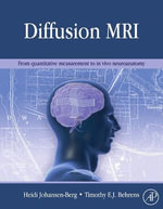 Diffusion MRI : From quantitative measurement to in-vivo neuroanatomy - Heidi Johansen-Berg