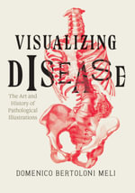 Visualizing Disease : The Art and History of Pathological Illustrations - Domenico Bertoloni Meli