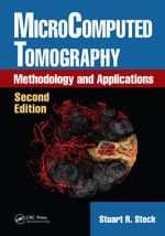 MicroComputed Tomography : Methodology and Applications - Stuart R. Stock