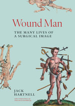 Wound Man : The Many Lives of a Surgical Image - Jack Hartnell
