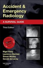 Accident and Emergency Radiology : 3rd Edition - A Survival Guide - Nigel Raby