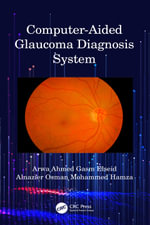Computer-Aided Glaucoma Diagnosis System - Arwa Ahmed Gasm Elseid
