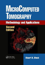 MicroComputed Tomography : Methodology and Applications, Second Edition - Stuart R. Stock