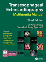 Transesophageal Echocardiography Multimedia Manual : A Perioperative Transdisciplinary Approach - Andre  Denault MD PhD