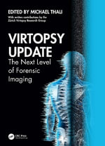 Virtopsy Update : The Next Level of Forensic Imaging - Michael Thali