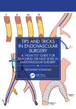 Tips and Tricks in Endovascular Surgery : A 