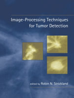 Image-Processing Techniques for Tumor Detection - Robin N. Strickland
