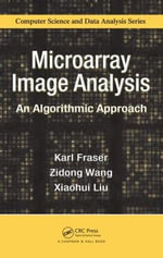 Microarray Image Analysis : An Algorithmic Approach - Karl Fraser
