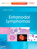 Extranodal Lymphomas E-Book : Expert Consult - Online and Print - Judith A. Ferry