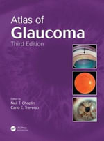Atlas of Glaucoma - Carlo E.  Traverso