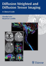 Diffusion Weighted and Diffusion Tensor Imaging : A Clinical Guide - Claudia Leite