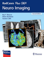 RadCases Plus Q &A : Neuro Imaging : 2nd Edition - Eliana Bonfante