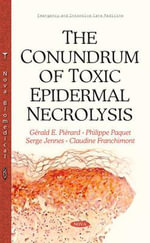 Conundrum of Toxic Epidermal Necrolysis - Claudine Franchimont