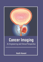 Cancer Imaging : An Engineering and Clinical Perspective - Heath Howard