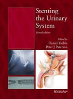 Stenting the Urinary System - Daniel Yachia