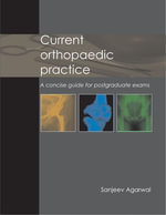 Current Orthopaedic Practice : A concise guide for postgraduate exams - Sanjeev Agarwal
