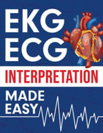 EKG | ECG Interpretation Made Easy - NEDU