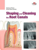 Shaping and Cleaning the Root Canals - Gianluca Plotino