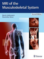 MRI of the Musculoskeletal System : 2nd Edition - Martin Vahlensieck