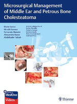Microsurgical Management of Middle Ear and Petrous Bone Cholesteatoma - Abdelkader Taibah