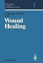 Fibrin Sealing in Surgical and Nonsurgical Fields - GÃ¼nther Schlag