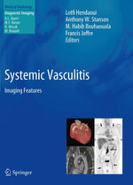 Systemic Vasculitis : Imaging Features - Lotfi Hendaoui