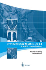 Protocols for Multislice CT : 4- and 16-row Applications - Roland Bruening
