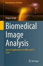 Biomedical Image Analysis : Special Applications in MRIs and CT scans - Pritpal Singh