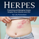Herpes : Preventing and Managing Herpes Simplex Virus Infection and HSV - Lily Richardsen