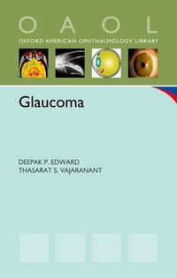 Glaucoma : Oxford American Ophthamology Library - Deepak P. Edward