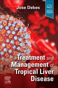 Treatment and Management of Tropical Liver Disease - Jose Debes