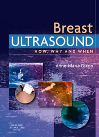 Breast Ultrasound : How, Why and When - Anne-Marie Dixon