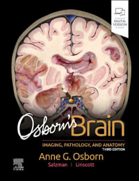 Osborn's Brain - Anne G., MD, FACR  Osborn