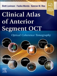 Clinical Atlas of Anterior Segment Ocular Coherence Tomography : Optical Coherence Tomography - Levinson