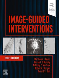 Image-Guided Interventions - E-BOOK : Expert Radiology Series - Matthew A. Mauro