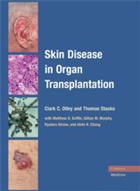 Skin Disease in Organ Transplantation - Clark C. Otley
