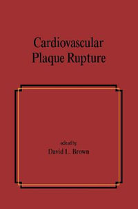 Cardiovascular Plaque Rupture : Fundamental and Clinical Cardiology - David L. Brown