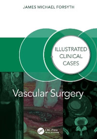 Vascular Surgery : Illustrated Clinical Cases - James Forsyth
