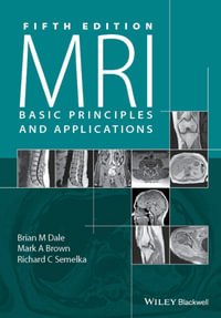 MRI: Basic Principles and Applications : Basic Principles and Applications - Brian M. Dale