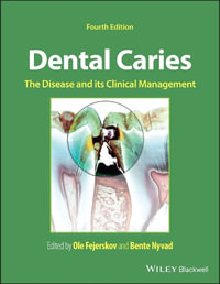 Dental Caries : The Disease and its Clinical Management - Ole Fejerskov