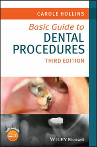 Basic Guide to Dental Procedures : Basic Guide Dentistry Series - Carole Hollins