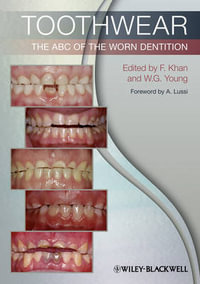 Toothwear : The ABC of the Worn Dentition - Farid Khan