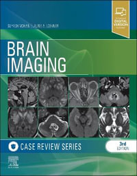 Brain Imaging : Case Review Series, 3e - Laurie Loevner