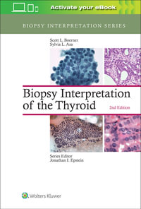 Biopsy Interpretation of the Thyroid : Biopsy Interpretation - Scott L. Boerner