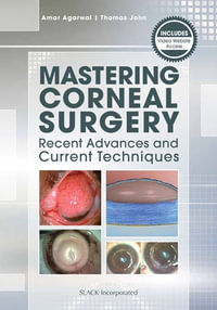 Mastering Corneal Surgery : Recent Advances and Current Techniques - Amar Agarwal