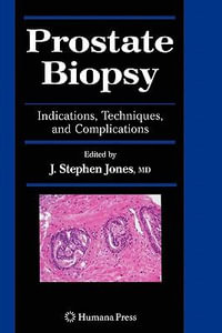 Prostate Biopsy : Indications, Techniques, and Complications - J. Stephen Jones