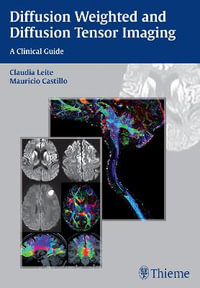 Diffusion Weighted and Diffusion Tensor Imaging : A Clinical Guide - Claudia Leite