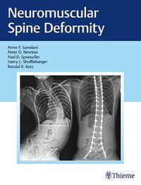 Neuromuscular Spine Deformity - Amer F. Samdani