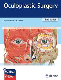Oculoplastic Surgery : Third Edition - Brian Leatherbarrow
